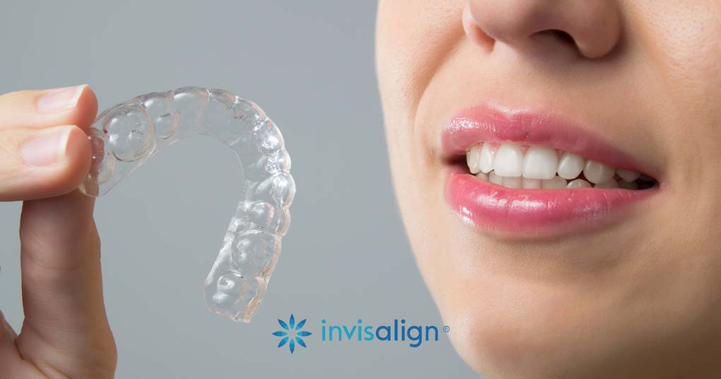 Philadelphia Invisalign Provider