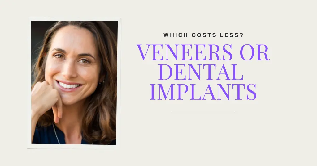 Veneers Or Implants Cost Blog Header
